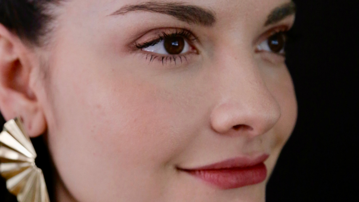 Tratamentos para cicatrizes de acne: laser e microagulhamento